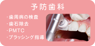 予防歯科